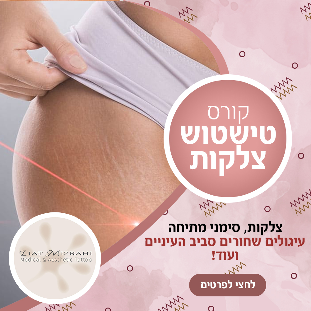 דוגמה נוספת לקמפיין ברשתות חברתיות 6